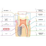 ナカニシ バリオスチップ ぺリオ