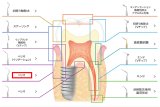 ナカニシ バリオスチップ ぺリオ