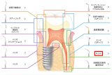 ナカニシ バリオスチップ エンド