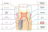 ナカニシ バリオスチップ エンド