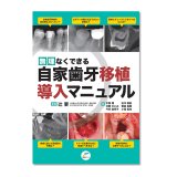 無理なくできる 自家歯牙移植導入マニュアル