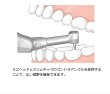 画像3: ナカニシ エンドメイト TC-2 (3)