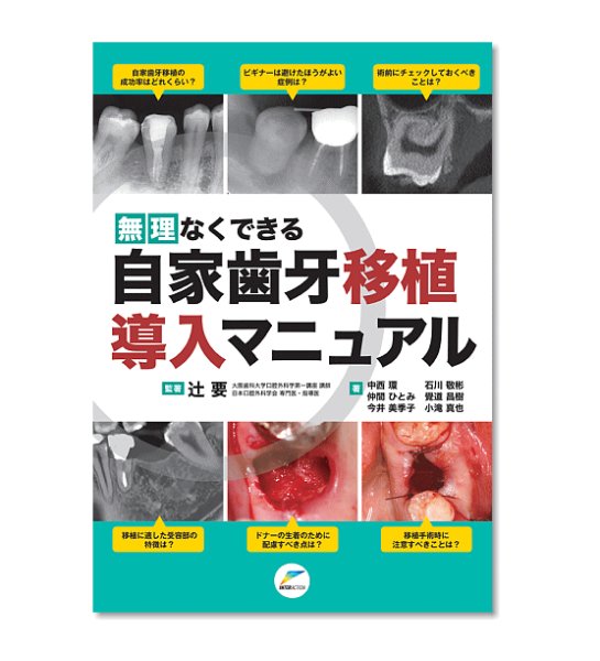 画像1: 無理なくできる 自家歯牙移植導入マニュアル (1)